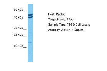 SAA4 Rabbit Polyclonal Antibody