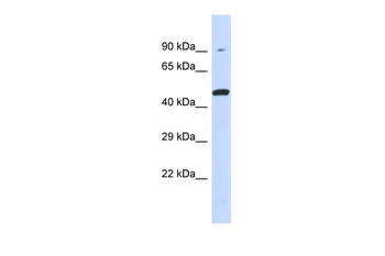 KIR3DL1 Rabbit Polyclonal Antibody