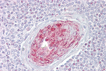 SLA Rabbit Polyclonal Antibody