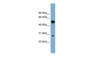 SLA Rabbit Polyclonal Antibody