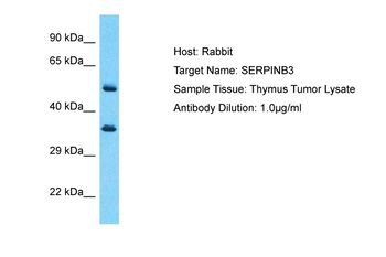 SERPINB3 Rabbit Polyclonal Antibody