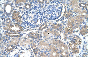 SARDH Rabbit Polyclonal Antibody