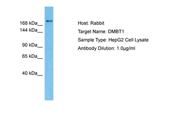 DMBT1 Rabbit Polyclonal Antibody
