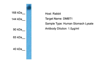 DMBT1 Rabbit Polyclonal Antibody