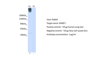 DMBT1 Rabbit Polyclonal Antibody