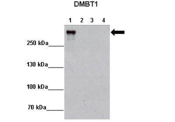 DMBT1 Rabbit Polyclonal Antibody