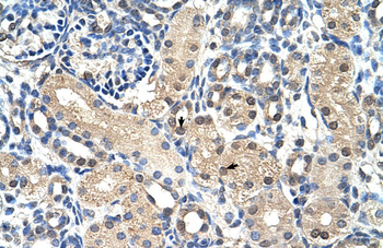 GPR161 Rabbit Polyclonal Antibody