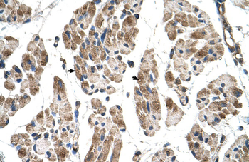 ITGB1BP2 Rabbit Polyclonal Antibody