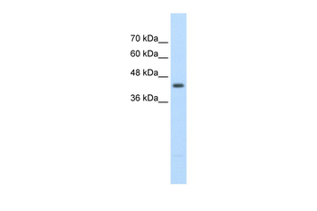 UPB1 Rabbit Polyclonal Antibody
