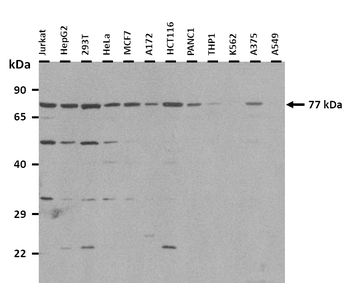 GTSE1 Rabbit Polyclonal Antibody