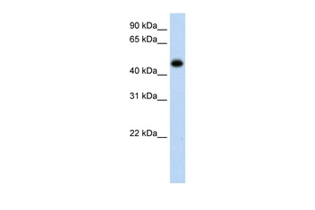 HAO1 Rabbit Polyclonal Antibody