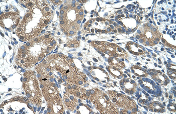 C21orf7 Rabbit Polyclonal Antibody