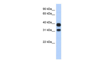 CHIA Rabbit Polyclonal Antibody