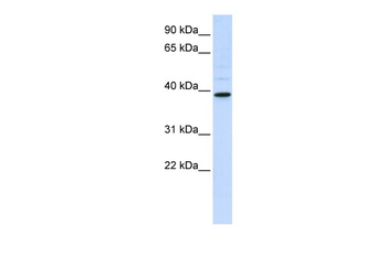 CHIA Rabbit Polyclonal Antibody