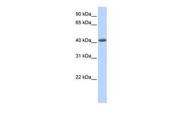 LRRC2 Rabbit Polyclonal Antibody