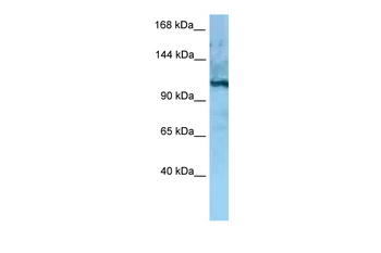 Morc4 Rabbit Polyclonal Antibody
