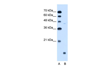 EDG8 Rabbit Polyclonal Antibody