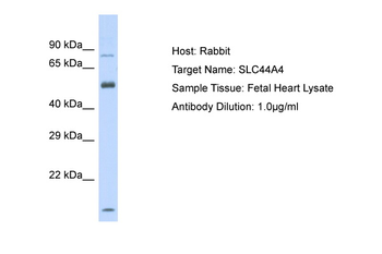 SLC44A4 Rabbit Polyclonal Antibody