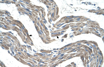 GPR161 Rabbit Polyclonal Antibody