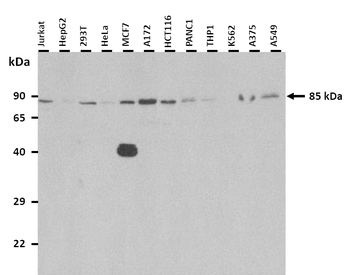 PLOD2 Rabbit Polyclonal Antibody