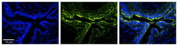 PLOD2 Rabbit Polyclonal Antibody