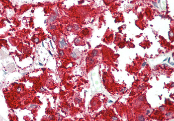RAPGEF2 Rabbit Polyclonal Antibody