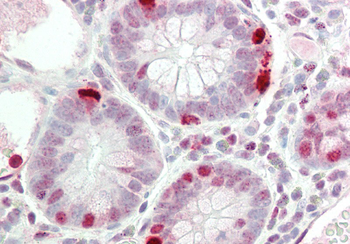 RAPGEF2 Rabbit Polyclonal Antibody