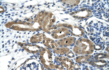 HDAC9 Rabbit Polyclonal Antibody