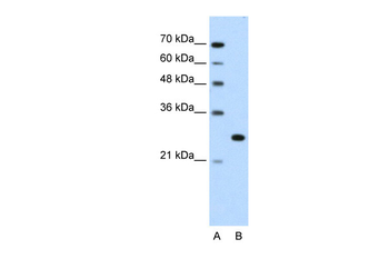 FOXR2 Rabbit Polyclonal Antibody