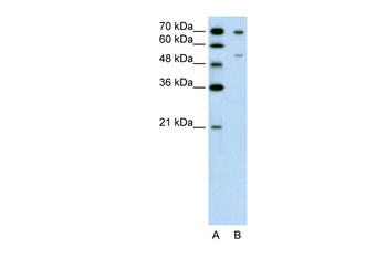 FOXB2 Rabbit Polyclonal Antibody