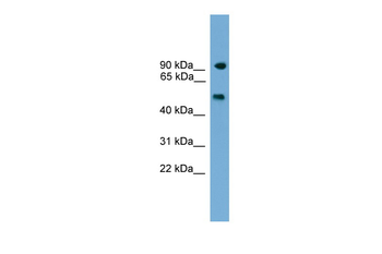 Parp8 Rabbit Polyclonal Antibody