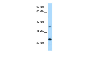 Rab13 Rabbit Polyclonal Antibody