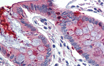 LIN7C Rabbit Polyclonal Antibody