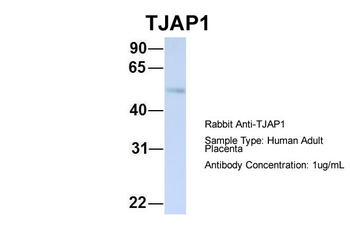 TJAP1 Rabbit Polyclonal Antibody