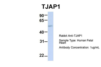 TJAP1 Rabbit Polyclonal Antibody