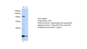 TJP2 Rabbit Polyclonal Antibody