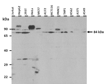 TRIM67 Rabbit Polyclonal Antibody
