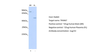TRIM67 Rabbit Polyclonal Antibody