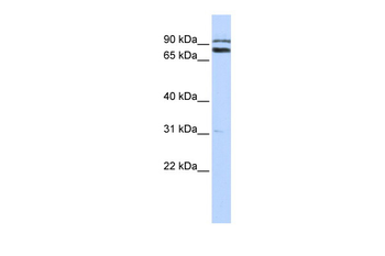 TRIM67 Rabbit Polyclonal Antibody