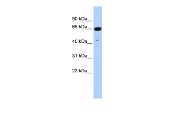 TRIM72 Rabbit Polyclonal Antibody