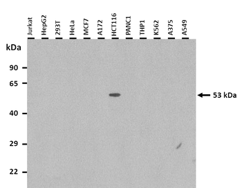 TRIM72 Rabbit Polyclonal Antibody
