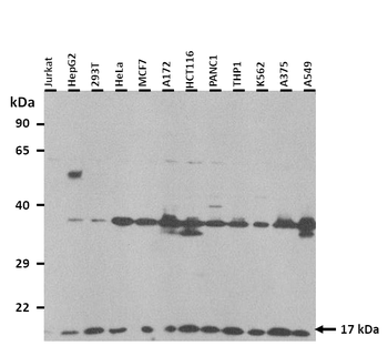 UBE2D2 Rabbit Polyclonal Antibody