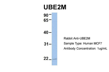 UBE2M Rabbit Polyclonal Antibody