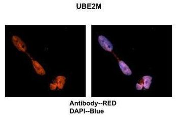 UBE2M Rabbit Polyclonal Antibody