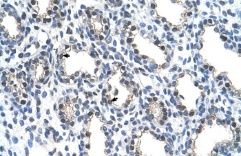 THOC4 Rabbit Polyclonal Antibody