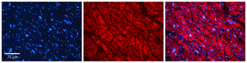 STUB1 Rabbit Polyclonal Antibody