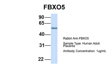 FBXO5 Rabbit Polyclonal Antibody