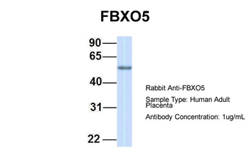 FBXO5 Rabbit Polyclonal Antibody