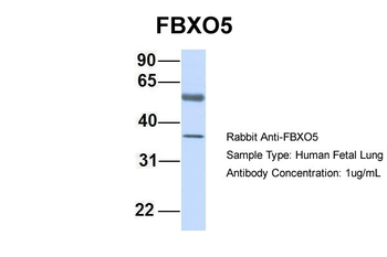 FBXO5 Rabbit Polyclonal Antibody
