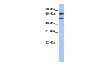 FBXO7 Rabbit Polyclonal Antibody